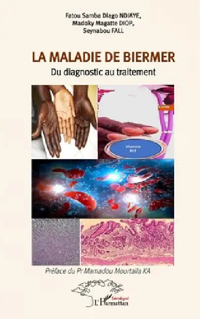La maladie de Biermer: Du diagnostic au traitement by Fatou Samba Diago Ndiaye, Madoky Magatte Diop, Seynabou Fall