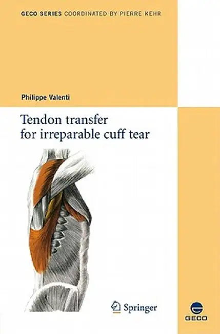 Tendon Transfer for Irreparable Cuff Tear by Philippe Valenti