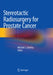 Stereotactic Radiosurgery for Prostate Cancer by Michael J. Zelefsky
