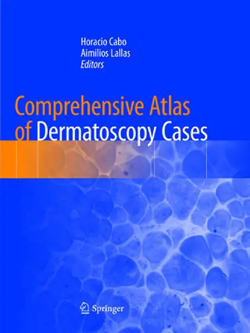 Comprehensive Atlas of Dermatoscopy Cases by Horacio Cabo