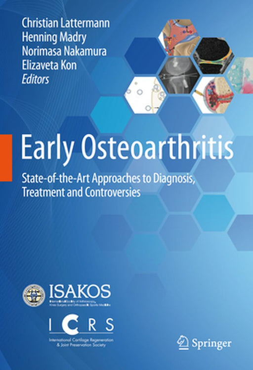 Early Osteoarthritis: State-Of-The-Art Approaches to Diagnosis, Treatment and Controversies by Christian Lattermann