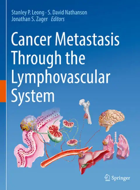 Cancer Metastasis Through the Lymphovascular System by Stanley P. Leong