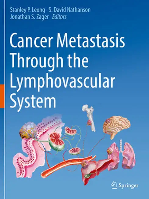 Cancer Metastasis Through the Lymphovascular System by Stanley P. Leong
