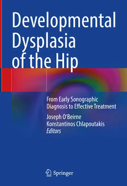 Developmental Dysplasia of the Hip: From Early Sonographic Diagnosis to Effective Treatment by Joseph O'Beirne