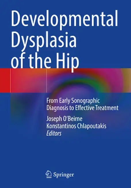 Developmental Dysplasia of the Hip: From Early Sonographic Diagnosis to Effective Treatment by Joseph O'Beirne