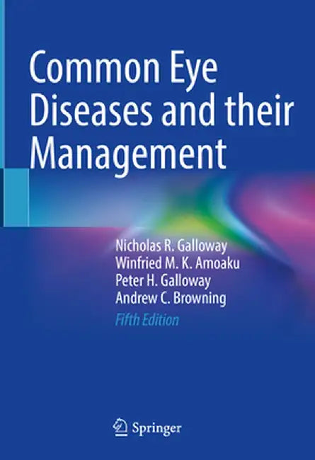 Common Eye Diseases and Their Management by Nicholas R. Galloway
