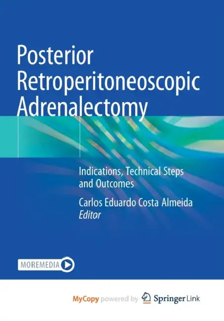 Posterior Retroperitoneoscopic Adrenalectomy: Indications, Technical Steps and Outcomes by Carlos Eduardo Costa Almeida