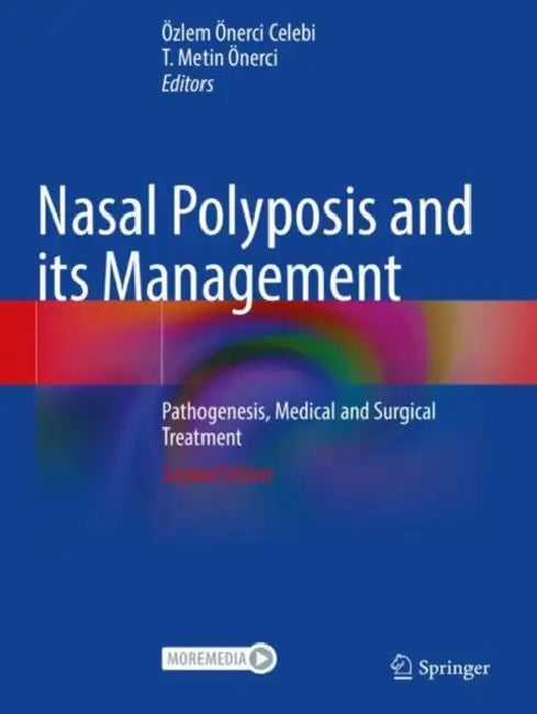 Nasal Polyposis and its Management: Pathogenesis, Medical and Surgical Treatment by Özlem Önerci Celebi