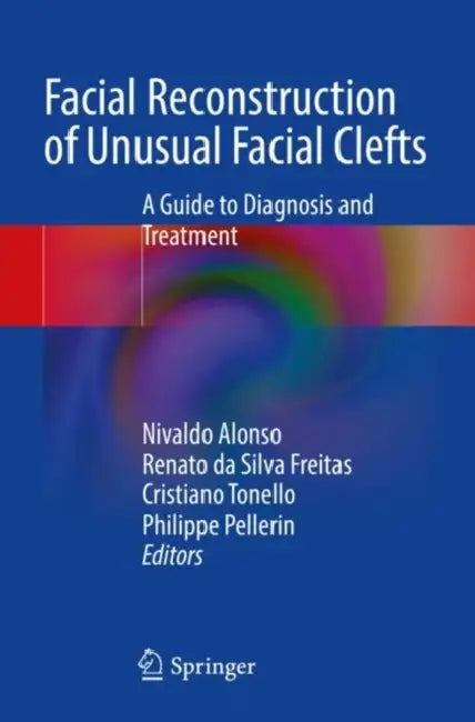 Facial Reconstruction of Unusual Facial Clefts: A Guide to Diagnosis and Treatment by Nivaldo Alonso
