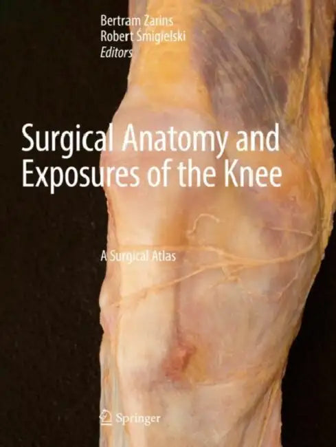 Surgical Anatomy and Exposures of the Knee: A Surgical Atlas by Bertram Zarins