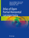 Atlas of Open Partial Horizontal Laryngectomy by Francesco Mattioli, Erika Crosetti, Michael Ghirelli