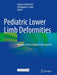 Pediatric Lower Limb Deformities: Principles and Techniques of Management by Sanjeev Sabharwal
