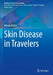 Skin Disease in Travelers by Wanda Robles