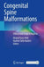 Congenital Spine Malformations: Clinical and Surgical Aspects by Khaled Fares Alali