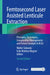 Femtosecond Laser Assisted Lenticule Extraction: Principles, Techniques, Complication Management, and Future Concepts in Klex by Walter Sekundo