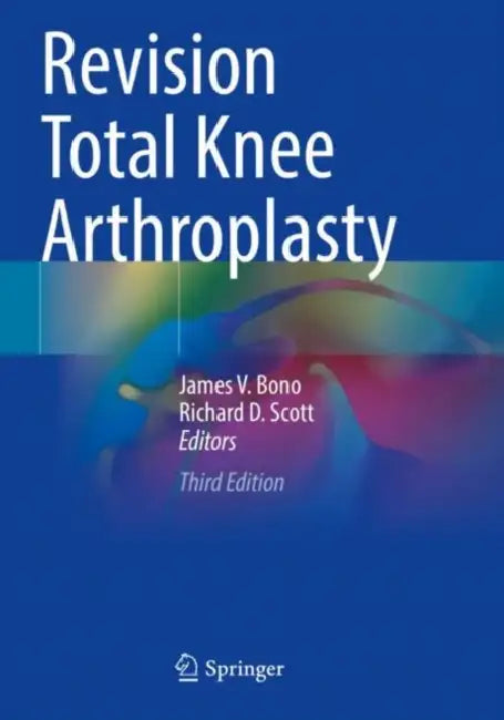 Revision Total Knee Arthroplasty by James V. Bono