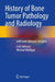 History of Bone Tumor Pathology and Radiology: With Lent Johnson's Insights by Lent Johnson