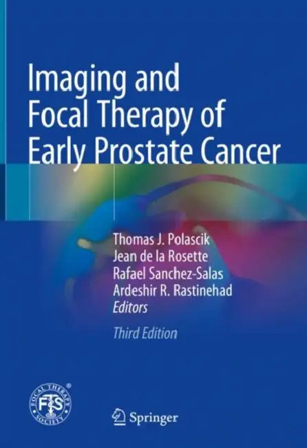 Imaging and Focal Therapy of Early Prostate Cancer by Thomas J. Polascik