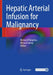 Hepatic Arterial Infusion for Malignancy by Michael D'Angelica