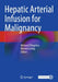 Hepatic Arterial Infusion for Malignancy by Michael D'Angelica