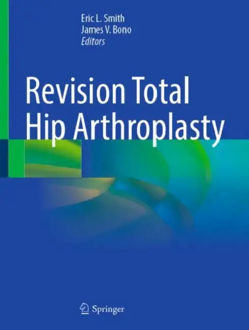 Revision Total Hip Arthroplasty by Eric L. Smith
