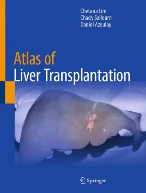 Atlas of Liver Transplantation by Chetana Lim