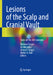 Lesions of the Scalp and Cranial Vault: State-Of-The-Art Concepts by Mehmet Turgut, Ali Akhaddar, Ahmet T. Turgut