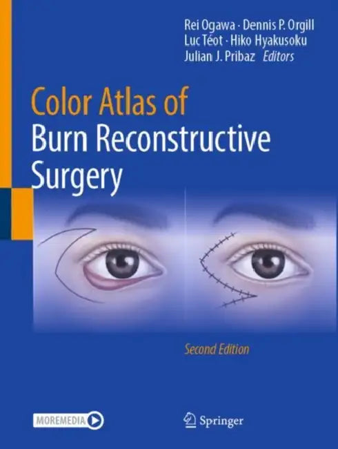 Color Atlas of Burn Reconstructive Surgery by Rei Ogawa