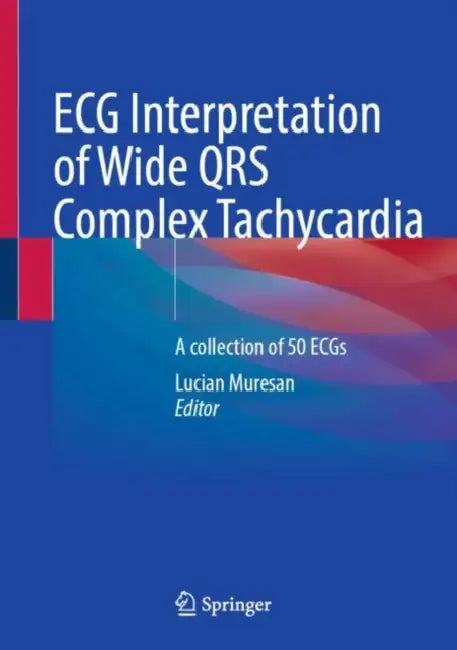ECG Interpretation of Wide QRS Complex Tachycardiaa: A Collection of 50 Ecgs by Lucian Muresan