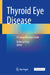 Thyroid Eye Disease: A Comprehensive Guide by Rebecca Ford