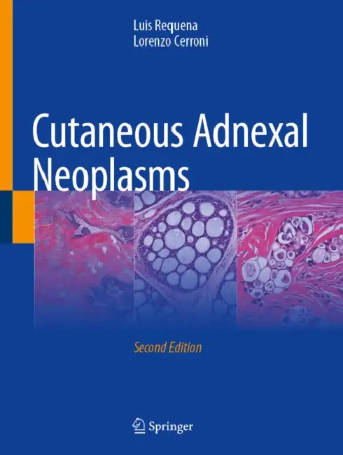 Cutaneous Adnexal Neoplasms by Luis Requena, Lorenzo Cerroni