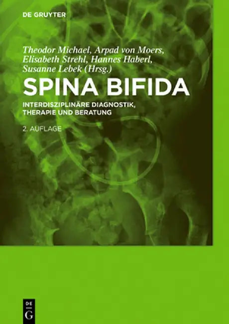 Spina Bifida: Interdisziplinare Diagnostik, Therapie Und Beratung by Theodor Michael