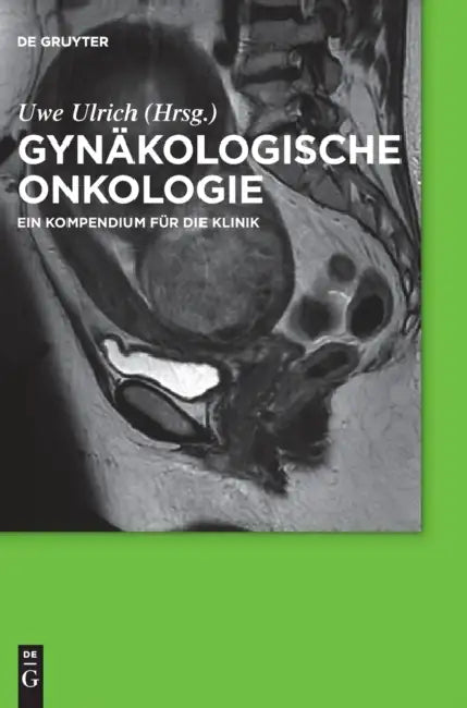 Gynakologische Onkologie: Ein Kompendium Fur Die Klinik by Uwe Ulrich