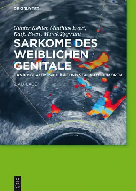 Glattmuskuläre und stromale Tumoren by Günter Köhler