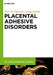 Placental Adhesive Disorders by José Miguel Palacios-Jaraquemada