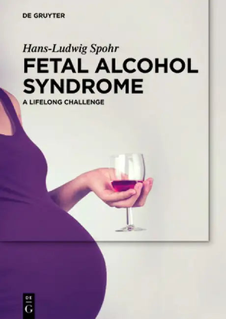 Fetal Alcohol Syndrome: In Childhood and Adulthood by Hans-Ludwig Spohr