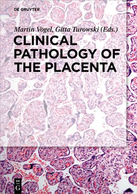 Clinical Pathology of the Placenta by Martin Vogel