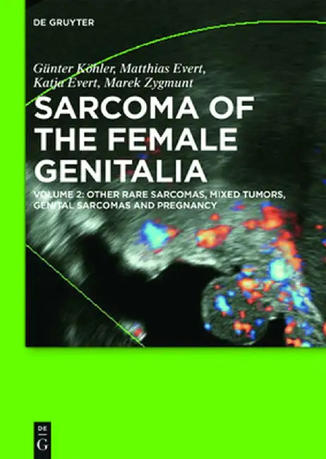 Other Rare Sarcomas, Mixed Tumors, Genital Sarcomas and Pregnancy: Volume 2: Other Rare Sarcomas, Mixed Tumors, Genital Sarcomas and Pregnancy by Gunter Kohler