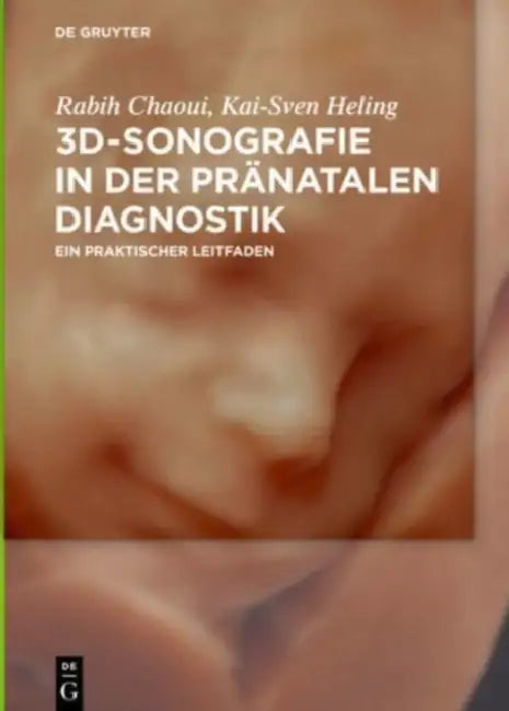 3D-Sonografie in Der Pranatalen Diagnostik: Ein Praktischer Leitfaden by Rabih Chaoui, Kai-Sven Heling
