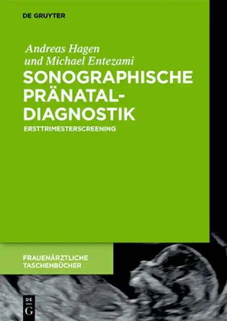 Sonographische Pränataldiagnostik: Ersttrimesterscreening by Andreas Hagen