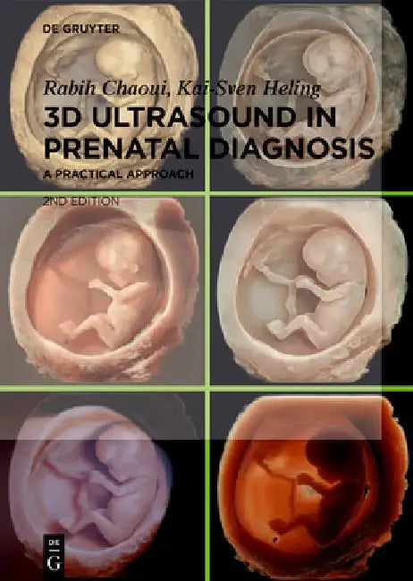 3D Ultrasound in Prenatal Diagnosis: A Practical Approach by Rabih Chaoui