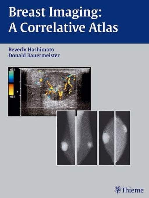 Breast Imaging: A Correlative Atlas by Beverly Hashimoto