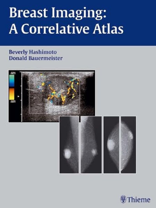 Breast Imaging: A Correlative Atlas by Beverly Hashimoto