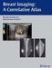 Breast Imaging: A Correlative Atlas by Beverly Hashimoto
