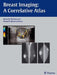Breast Imaging: A Correlative Atlas