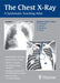 The Chest X-Ray: A Systematic Teaching Atlas by Matthias Hofer
