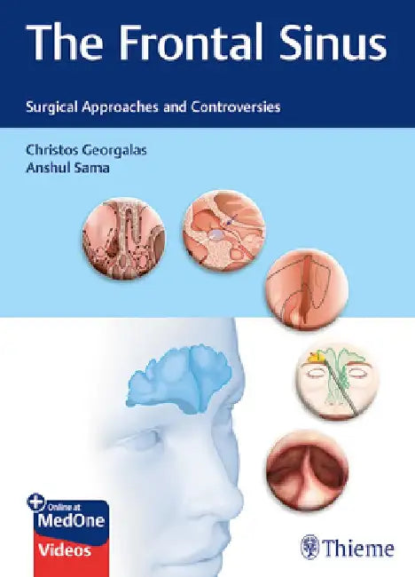 The Frontal Sinus: Surgical Approaches and Controversies by Christos Georgalas