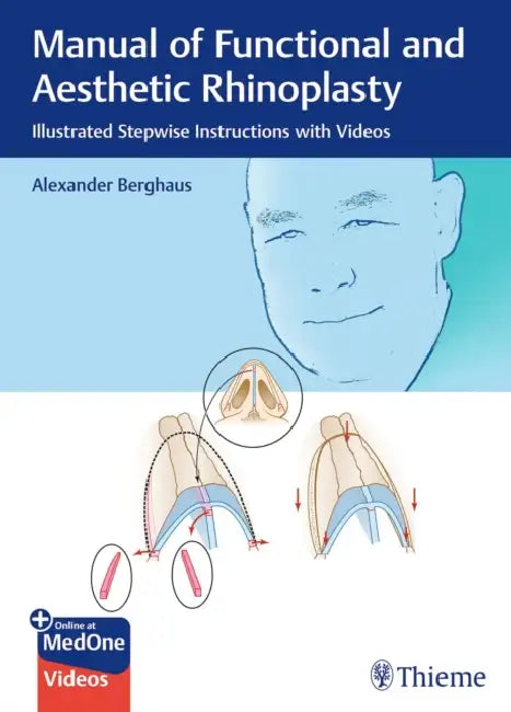 Manual of Functional and Aesthetic Rhinoplasty: Illustrated Stepwise Instructions with Videos by Alexander Berghaus
