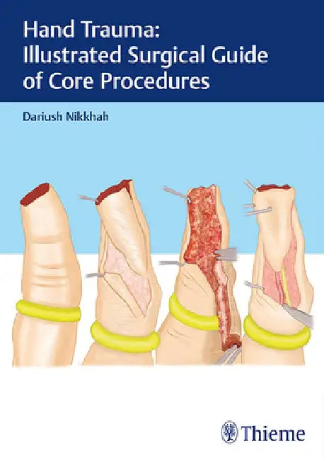 Hand Trauma: Illustrated Surgical Guide of Core Procedures by Dariush Nikkhah