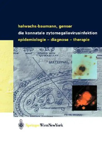 Die Konnatale Zytomegalievirusinfektion: Epidemiologie - Diagnose - Therapie by Gabriele Halwachs-Baumann, Bernd Genser